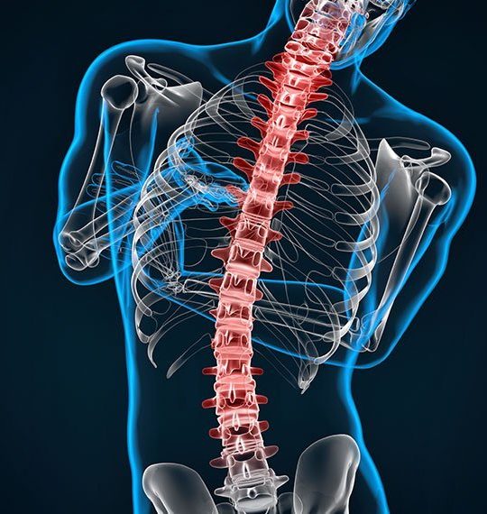 Diagram Scoliosis