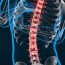 Spine image for scoliosis treatment in Singapore