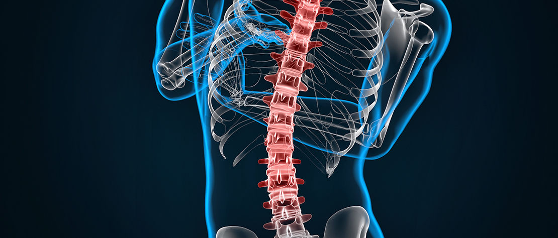 Spine-image-for-scoliosis-treatment-in-Singapore Spine image for scoliosis treatment in Singapore